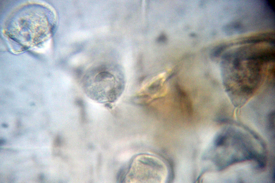 Due ciliati: Vorticella e .....